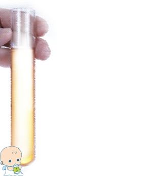 一般不妊検査・タイミング療法